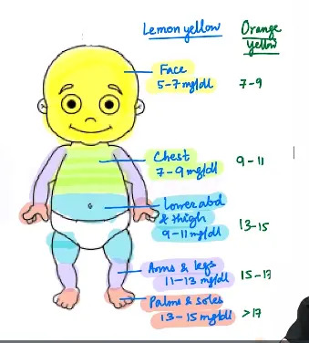 Kramer's rule for Neonatal Jaundice