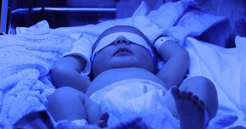 Neonatal Jaundice treatment with Phototherapy