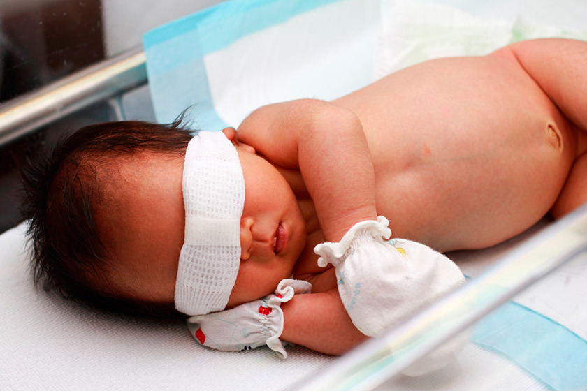 Newborn treatment Phototherapy