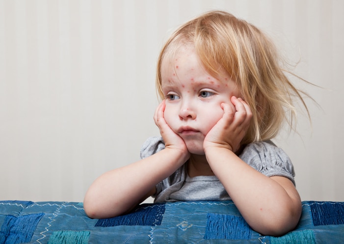 Pediatric rash treatment for kids in Vadodara